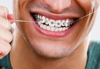 Orthodontie-Adulte-Dentiste-aix-en-provence